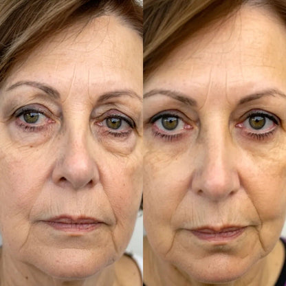 LumiEyes under-eye red light therapy image 4