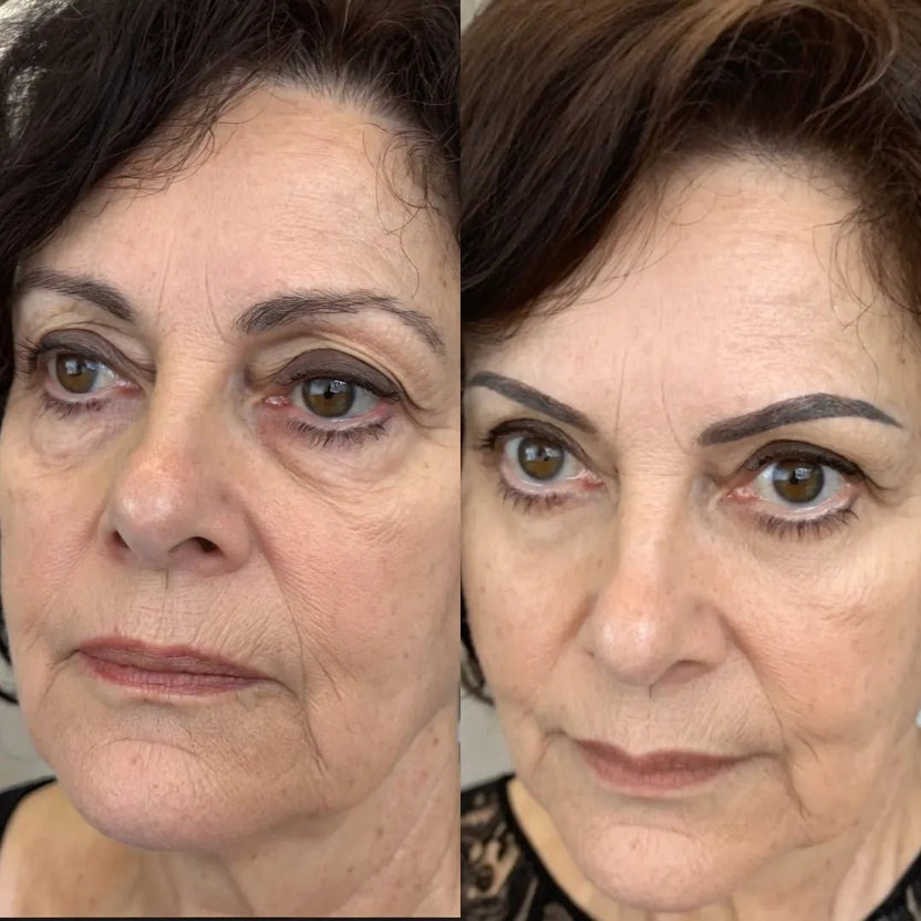 LumiEyes under-eye red light therapy image 6