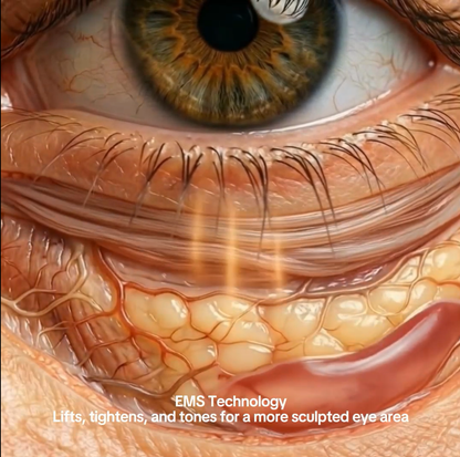 Luvée™ Dual Red Light + EMS Eye Rejuvenation Device 6